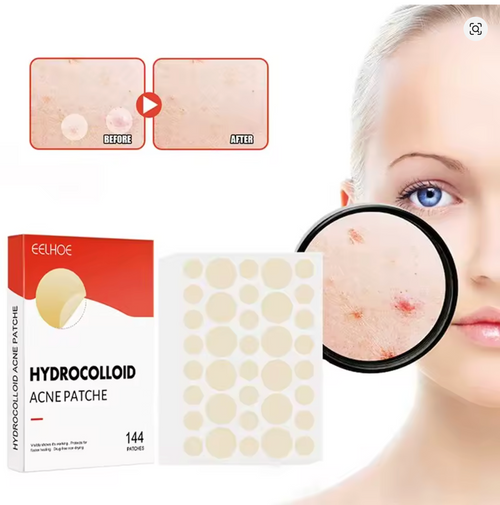 Parches para espinillas