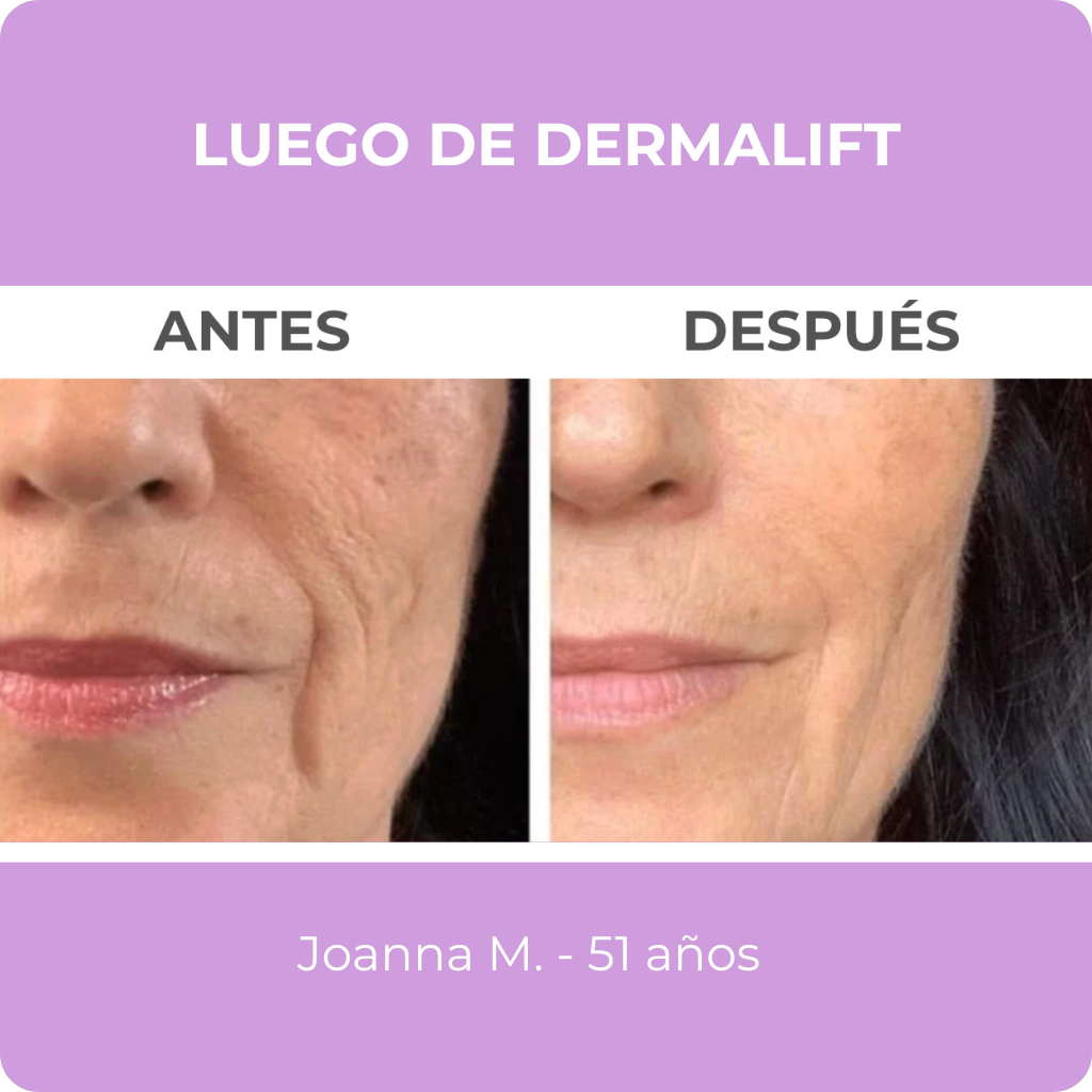 Dermalift -  Despierta con la piel descansada y lisa