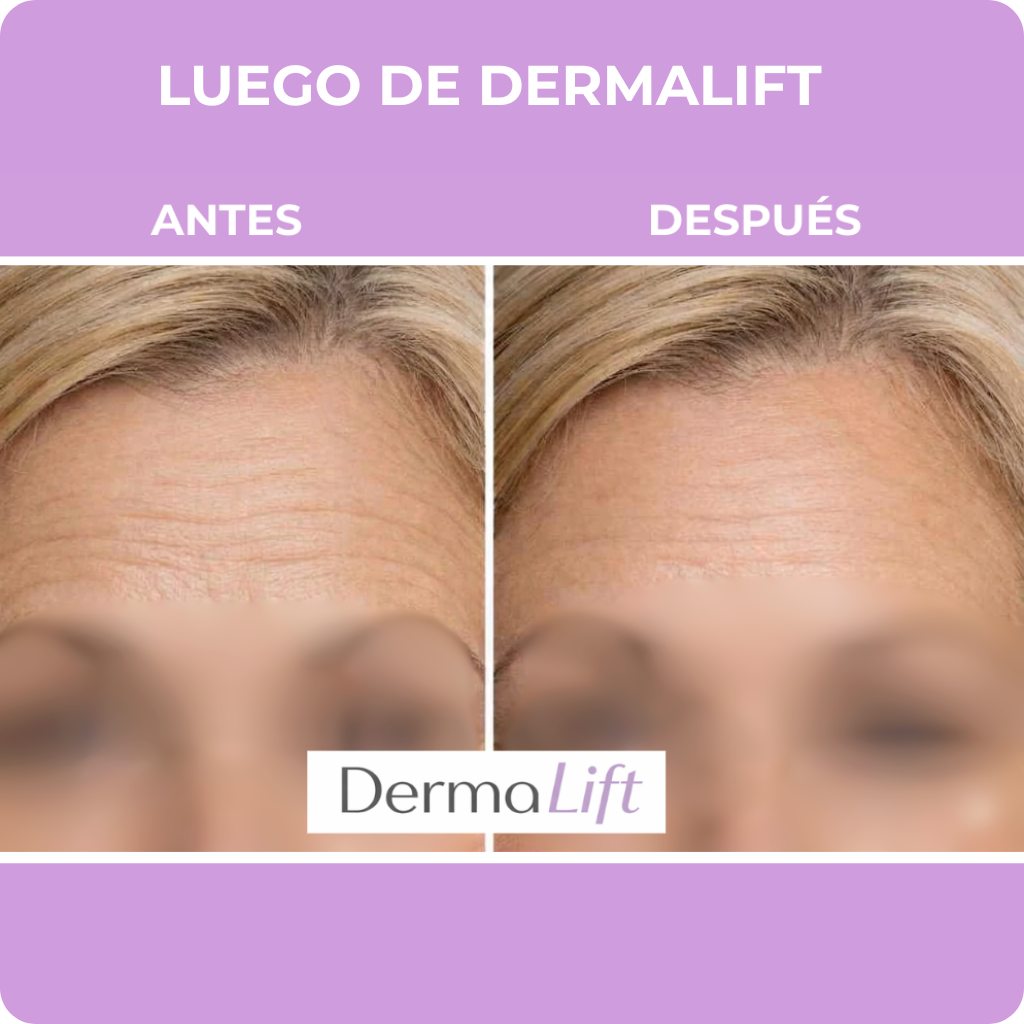 Dermalift -  Despierta con la piel descansada y lisa